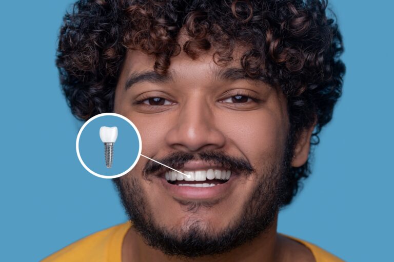 Dental Implants Are Almost Always Better