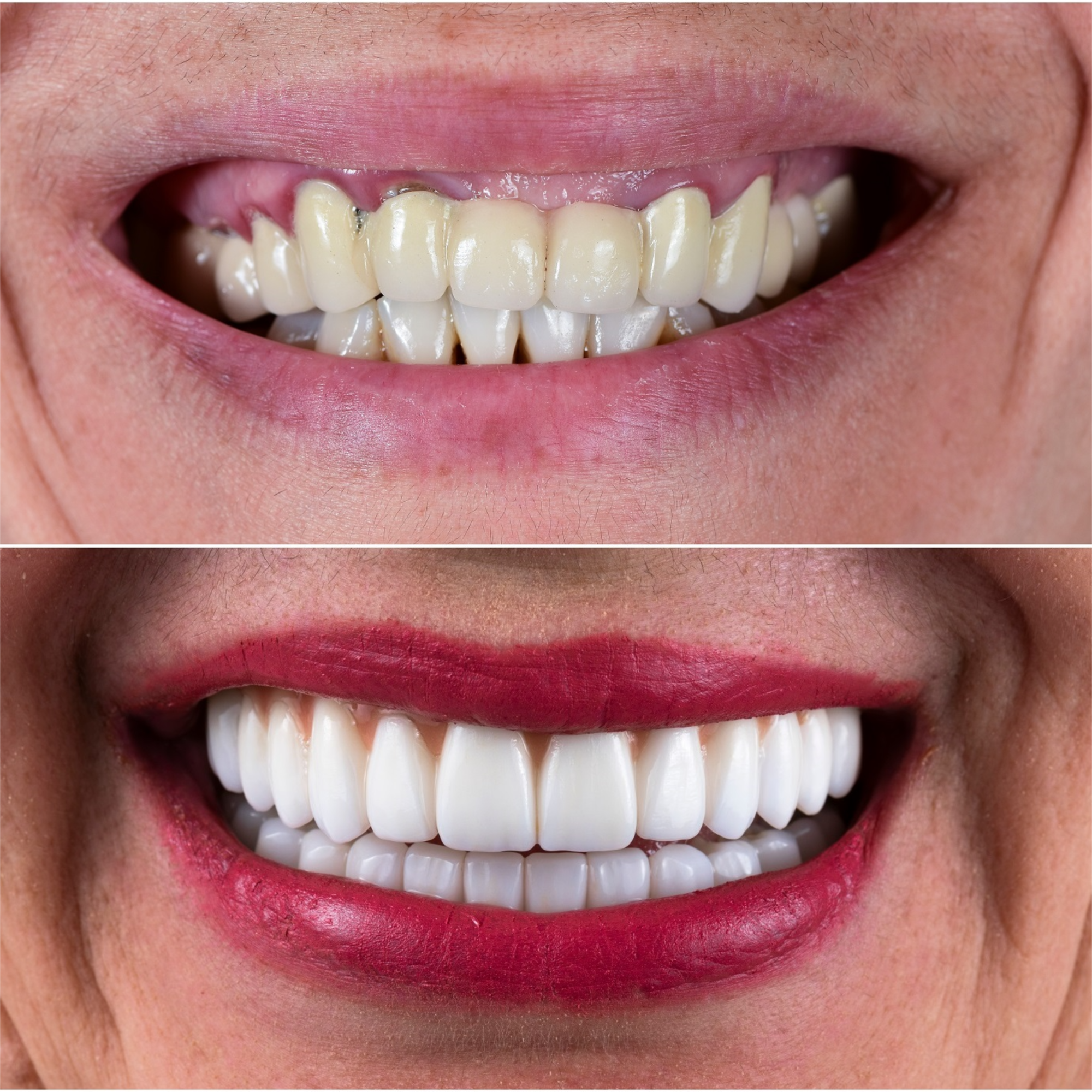 Dentures Before and After - Smile Science - Glendale, AZ