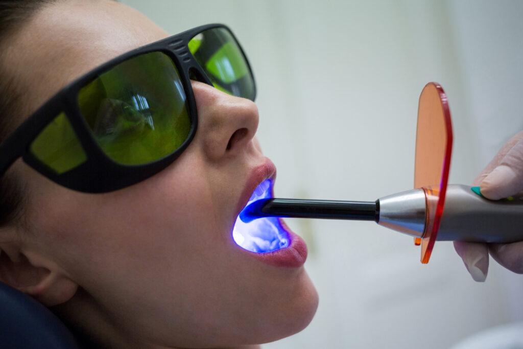 A dentist using a curing light to cure resin dental sealants on a female patient