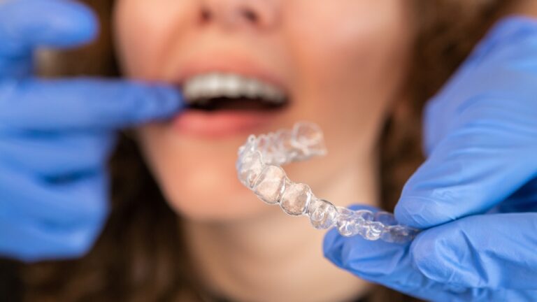 Invisalign Attachments Explained