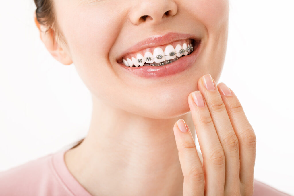 A smiling woman with braces is holding her chin.