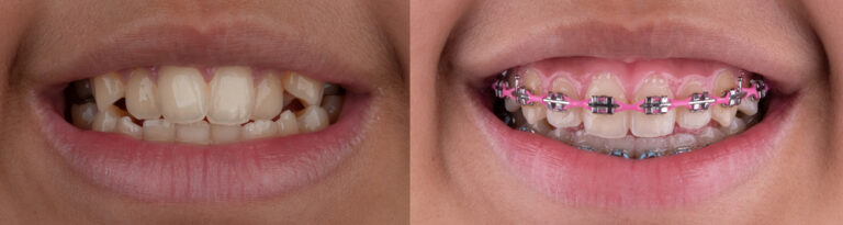 How Orthodontics Can Improve Your Life