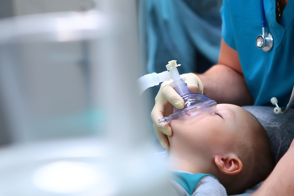 A child undergoes general anesthesia with a mask