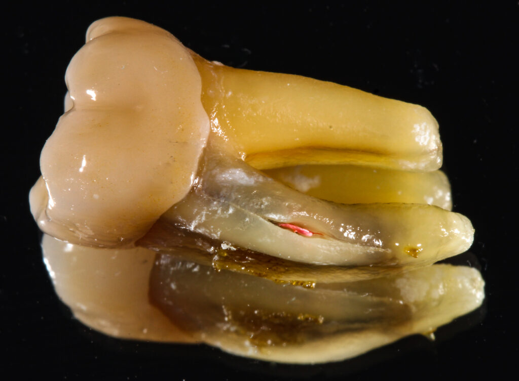A fractured molar root