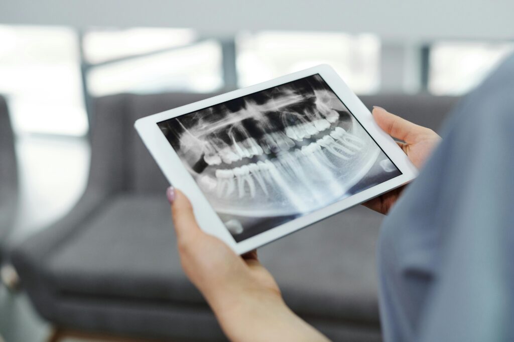 Person holding a tablet displaying a dental X-ray.