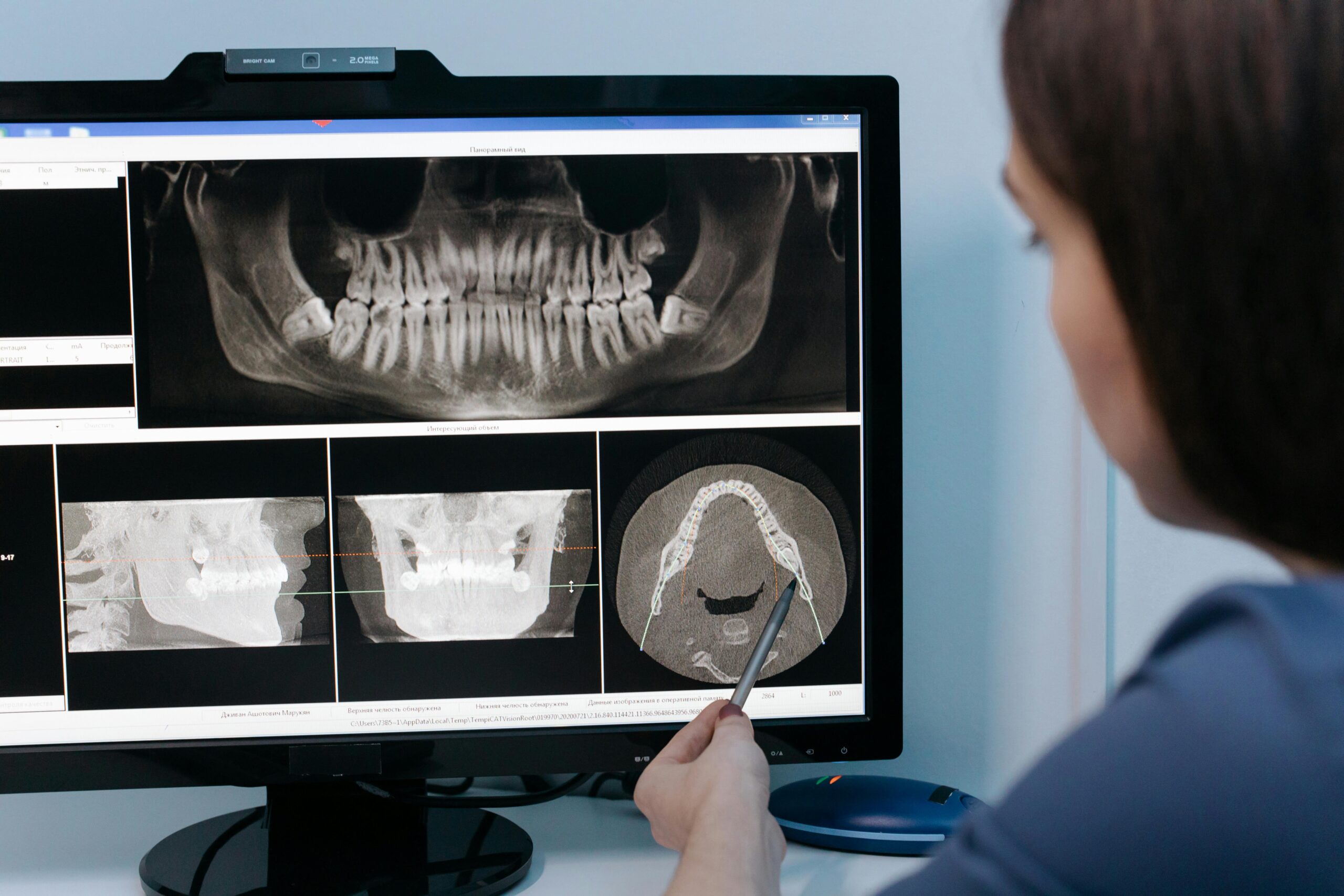 Dentist examining dental X-rays on a computer screen.