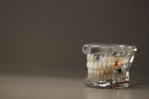 Dental model showing teeth and gums, related to sleep apnea oral appliances.