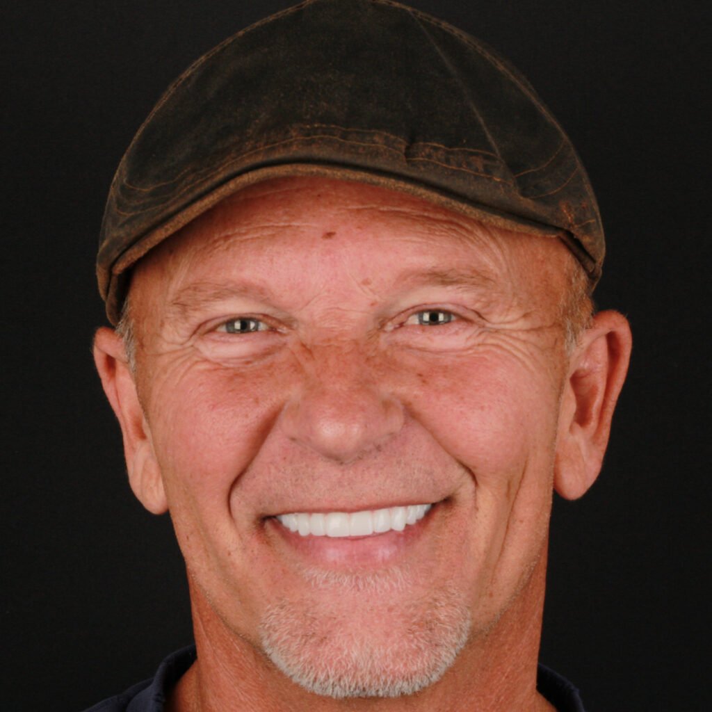 Implant Dentistry in Glendale, AZ | Smile Science Dental Spa 16 After