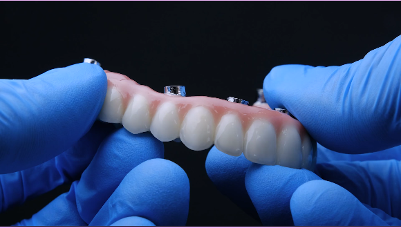 All-on-4® Implant Dentures in Glendale, AZ 10 All-on-4 monolithic zirconia in gloved hands