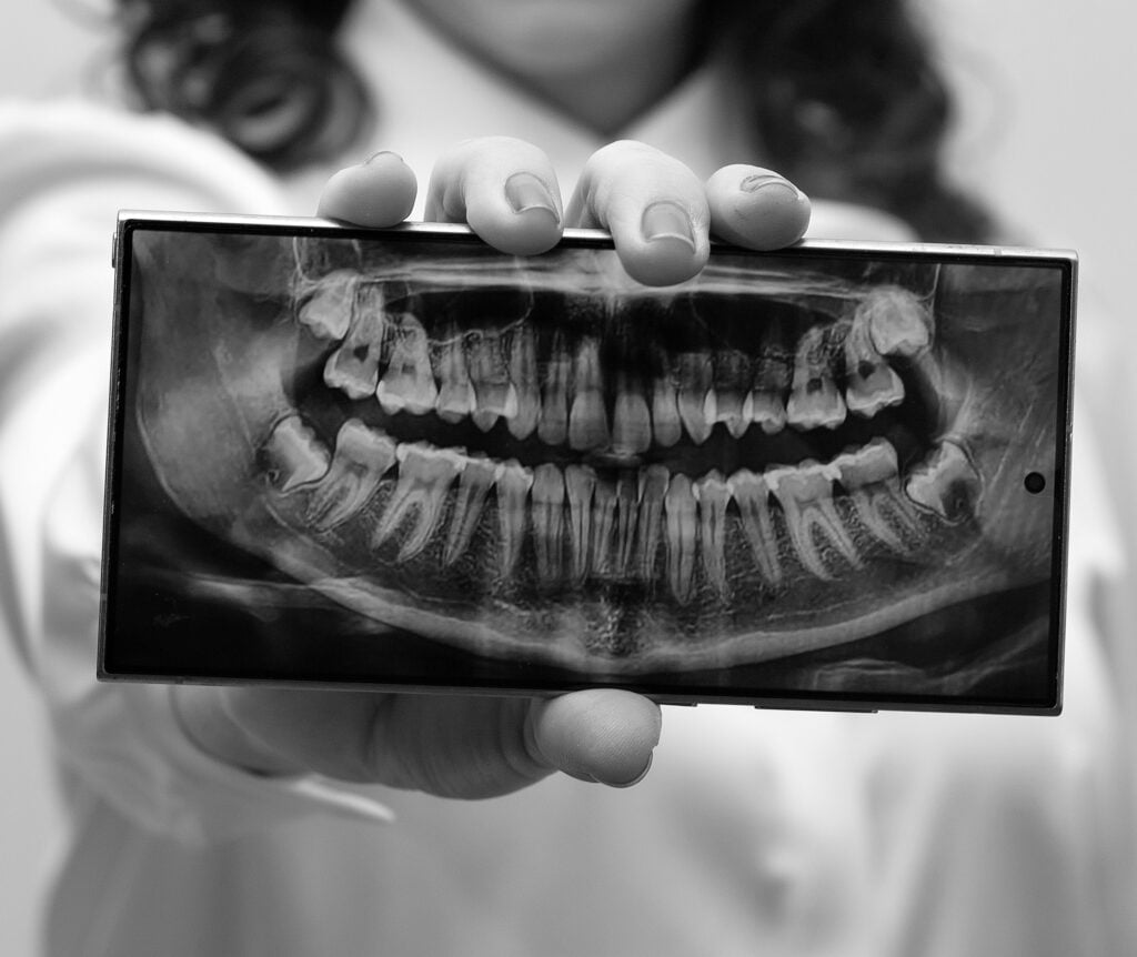 Person holding a dental X-ray image.