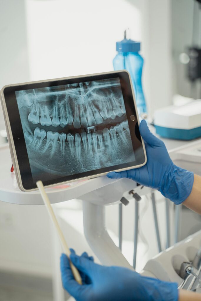 Gloved hands holding a dental X-ray on a tablet in a clinic.
