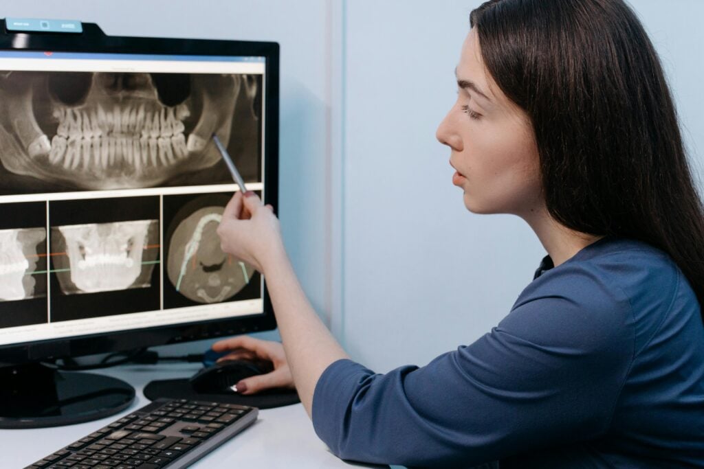 Person pointing at dental X-ray on computer screen.