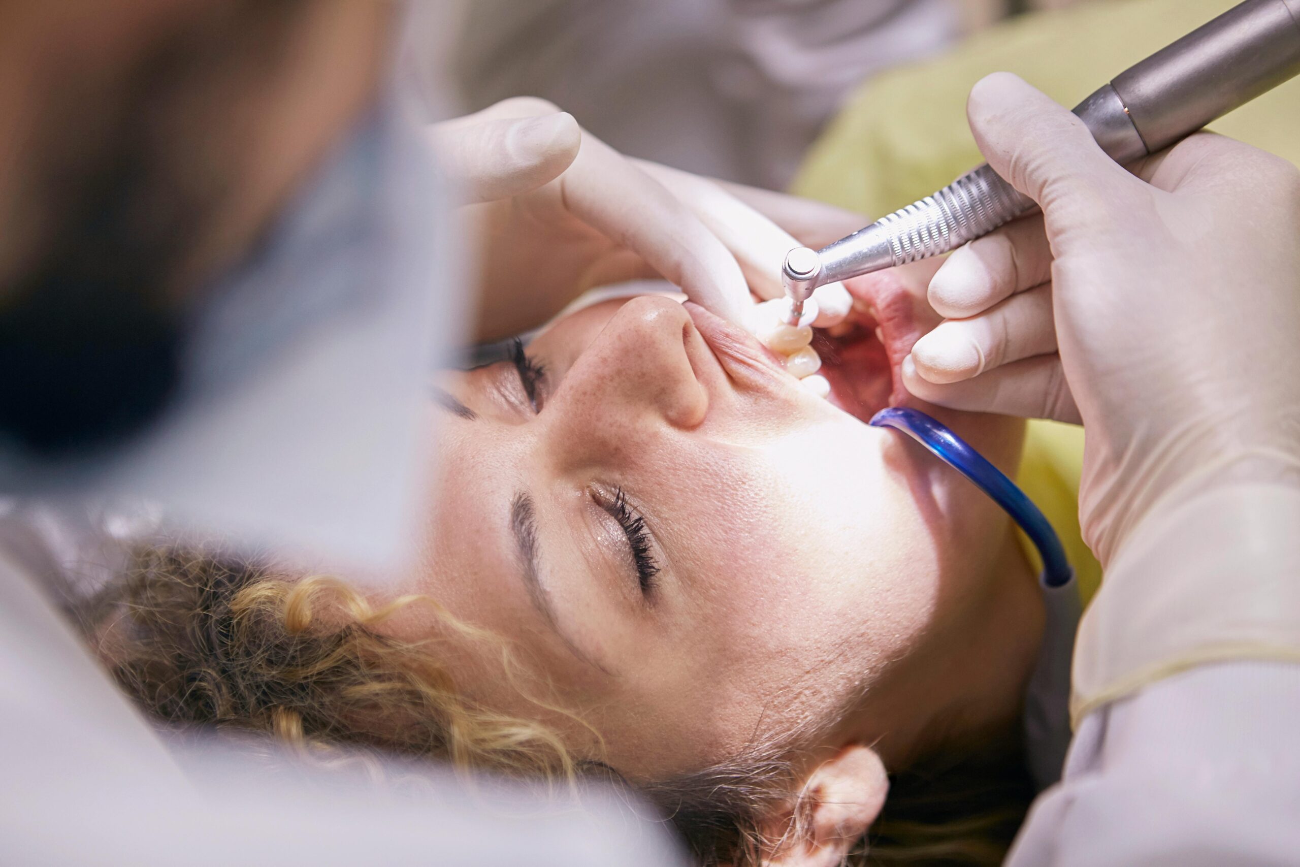 Dentist working on a patient's teeth with a dental tool.