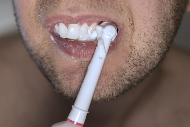 Top Oral Health Tips
