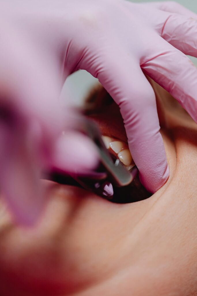 Dentist wearing pink gloves examining a patient's teeth.