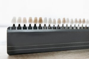 Dental shade guide for cosmetic dentistry options.