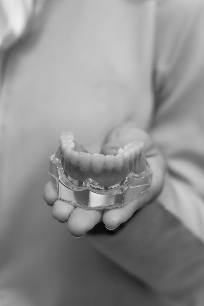 Hand holding a dental model, illustrating partial denture cost.
