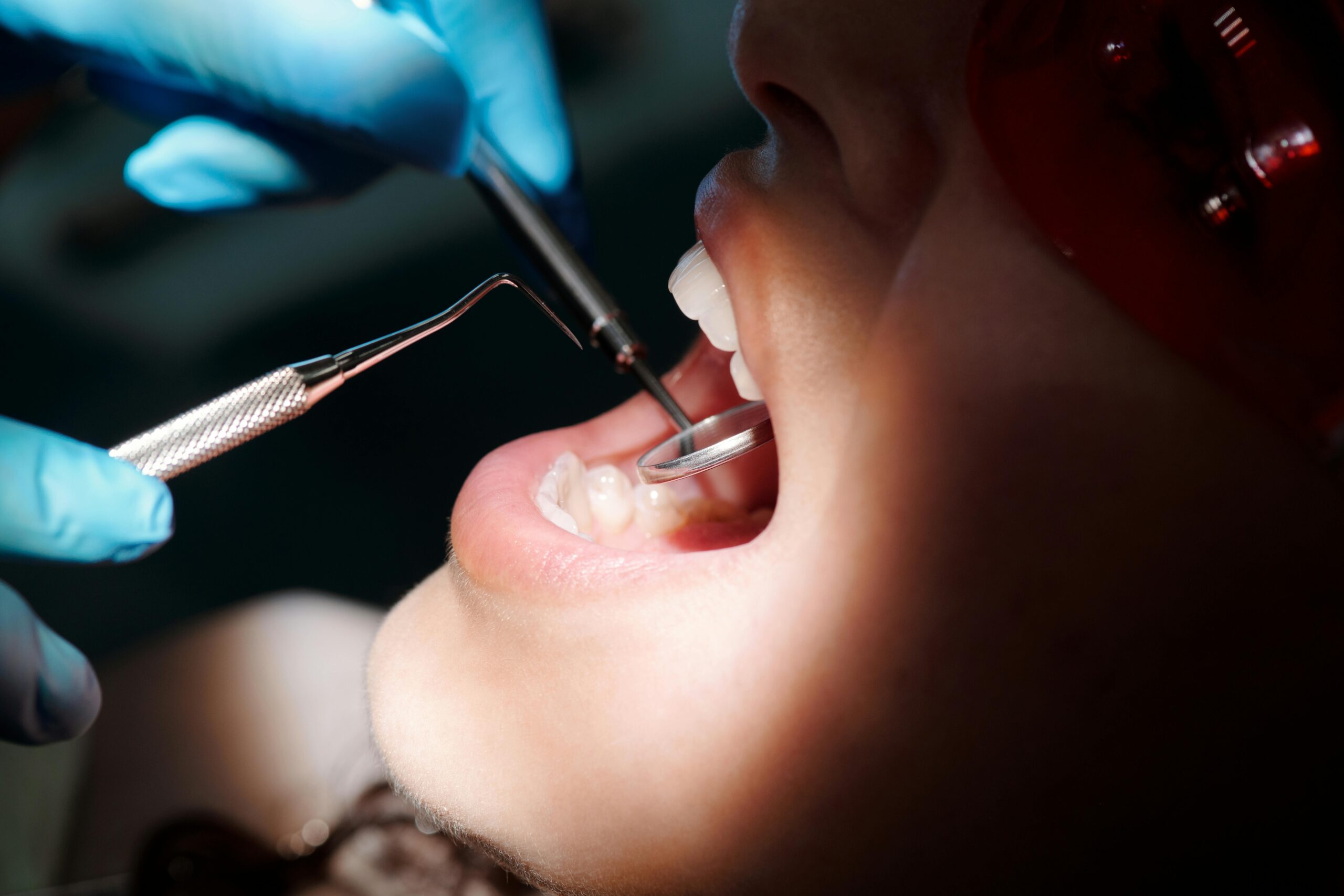 Dentist examining a patient's teeth with dental tools.