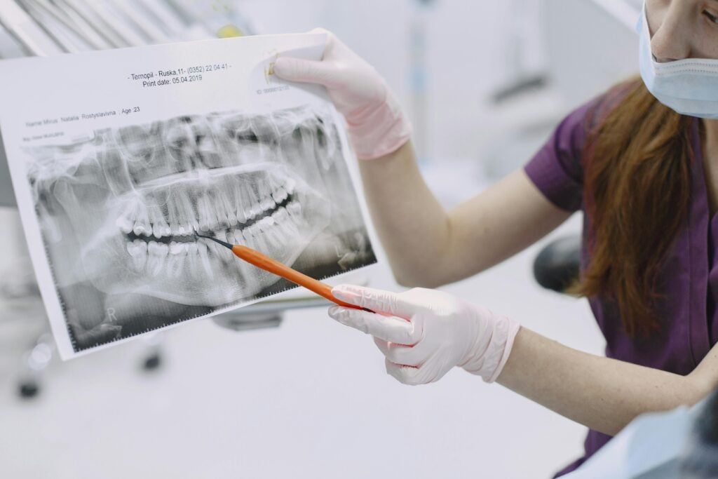 Dentist pointing at a dental X-ray with a pen.