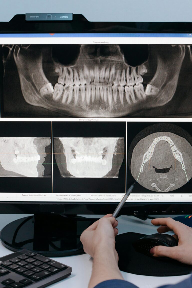 Tooth Loss: Common Causes