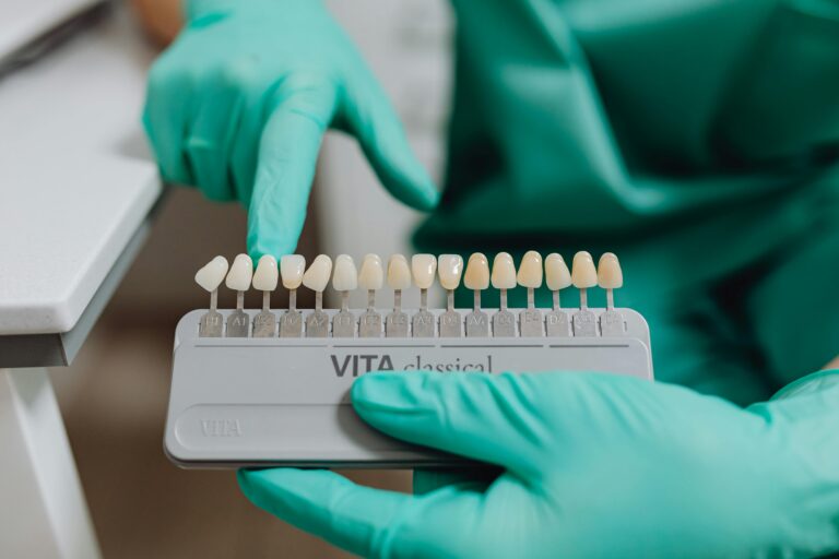 Emergency Tooth Extraction