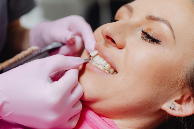 Effects of Smoking on Teeth