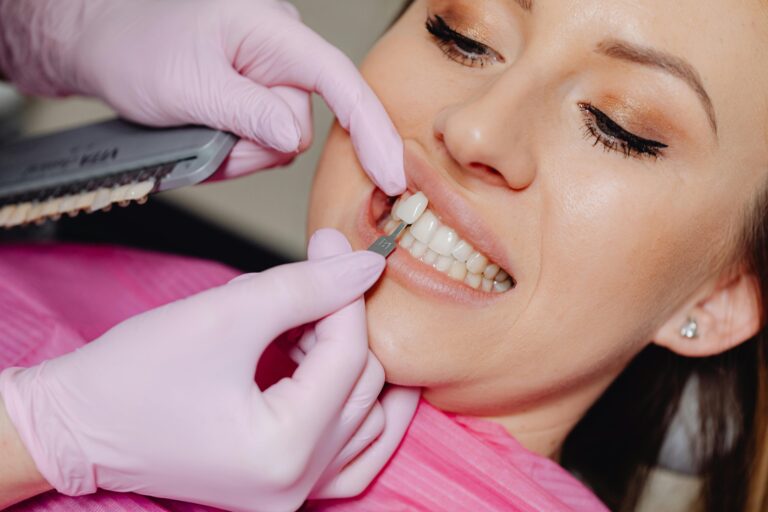 Veneers Before & After