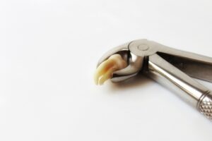 Extracted tooth held by dental forceps on white background.