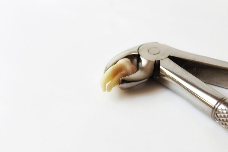Tooth Extraction Pain: What’s Normal