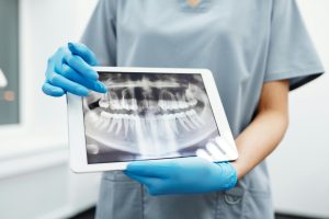 Dentist holding a tablet displaying a dental X-ray.