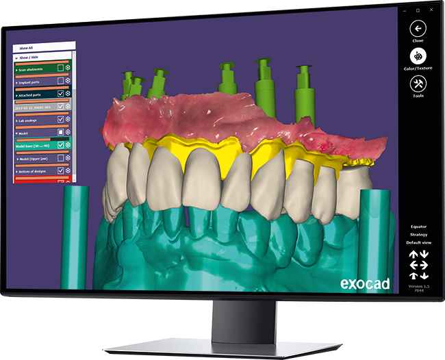 Exocad digital smile design software