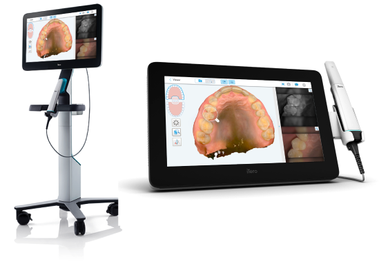 iTero Lumina intraoral scanner